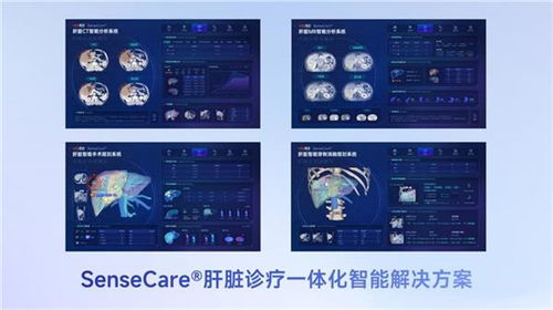 商湯醫療獲肝臟CT輔助診斷NMPA三類證，軟硬件零售賦能肝臟診療一體化新格局